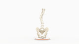 Scoliosis Type-2 Model 5