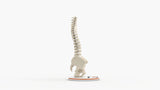Scoliosis Type-2 Model 5
