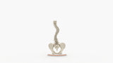 Scoliosis Type-2 Model 6
