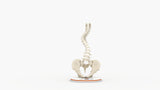 Scoliosis Type-2 Model 6