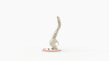 Scoliosis Type-2 Model 6