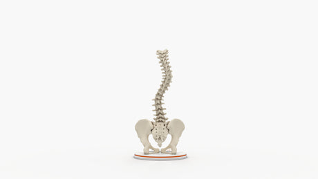 Scoliosis Type-2 Model 7