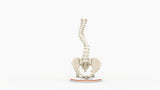 Scoliosis Type-2 Model 7