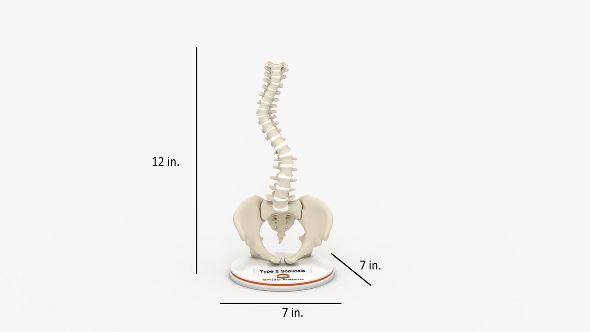 Scoliosis Type-2 Model 7