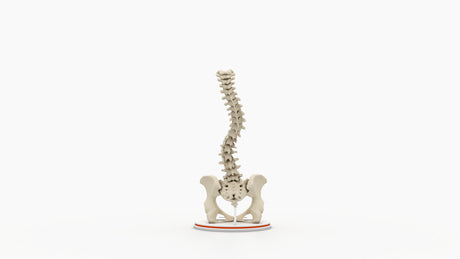 Scoliosis Type-2 Model 8