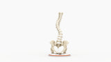 Scoliosis Type-2 Model 8