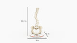 Scoliosis Type-2 Model 8