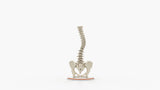 Scoliosis Type-2 Model 9