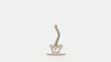 Scoliosis Type-3 Model 1