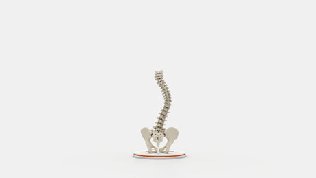 Scoliosis Type-3 Model 1