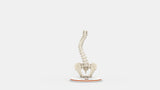 Scoliosis Type-3 Model 1