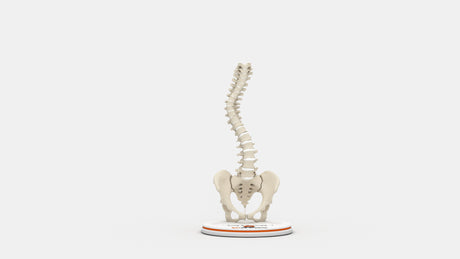 Scoliosis Type-3 Model 2