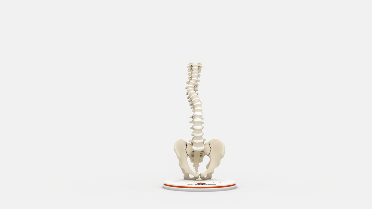 Scoliosis Type-4 Model 1