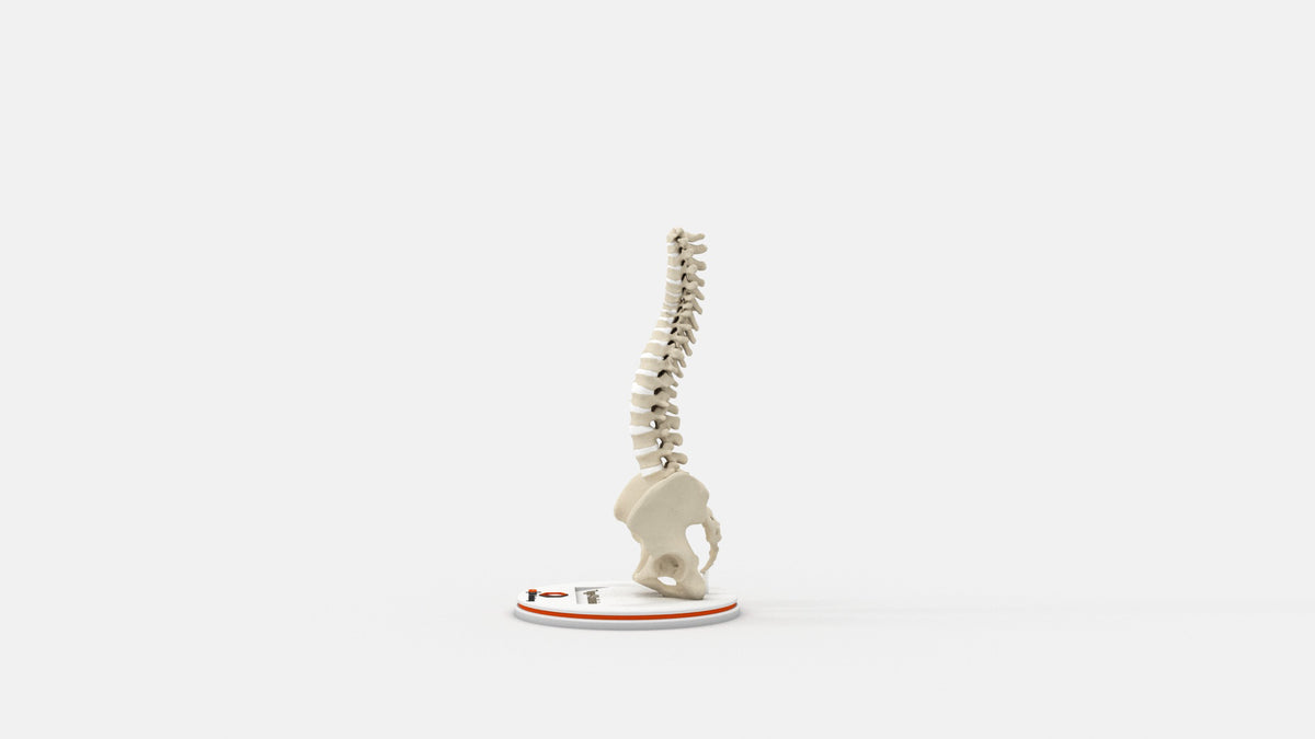 Scoliosis Type-4 Model 1