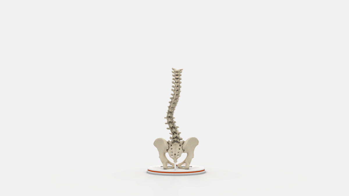 Scoliosis Type-5 Model 1