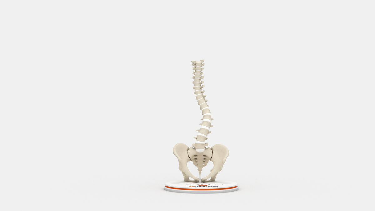 Scoliosis Type-5 Model 1