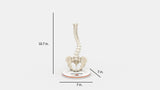 Scoliosis Type-5 Model 1