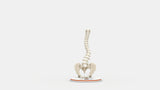 Scoliosis Type-6 Model 2