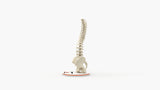 Scoliosis Type-1 Idiopathic 3