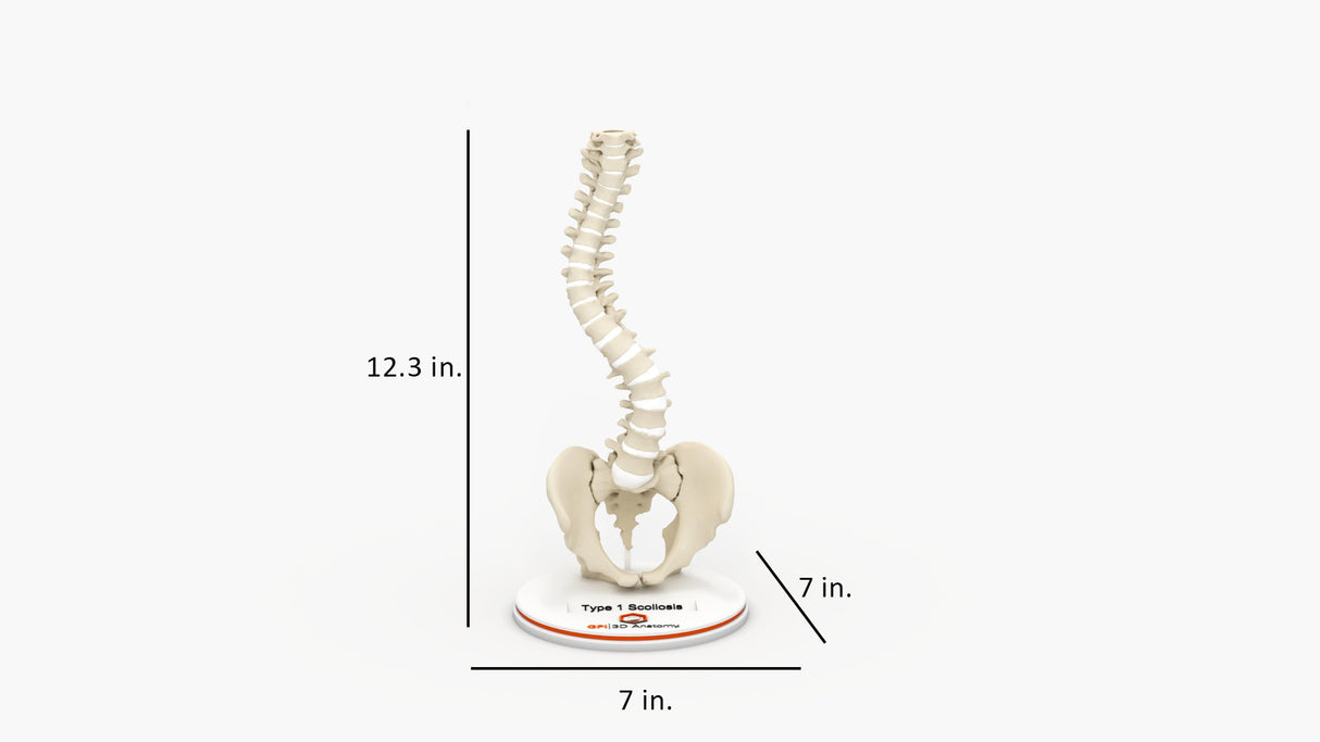 Scoliosis Type-1 Idiopathic 3