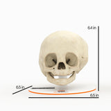 Infant Skull With Unilateral Craniosynostosis of the Lambdoid Suture - Female, 7 Months