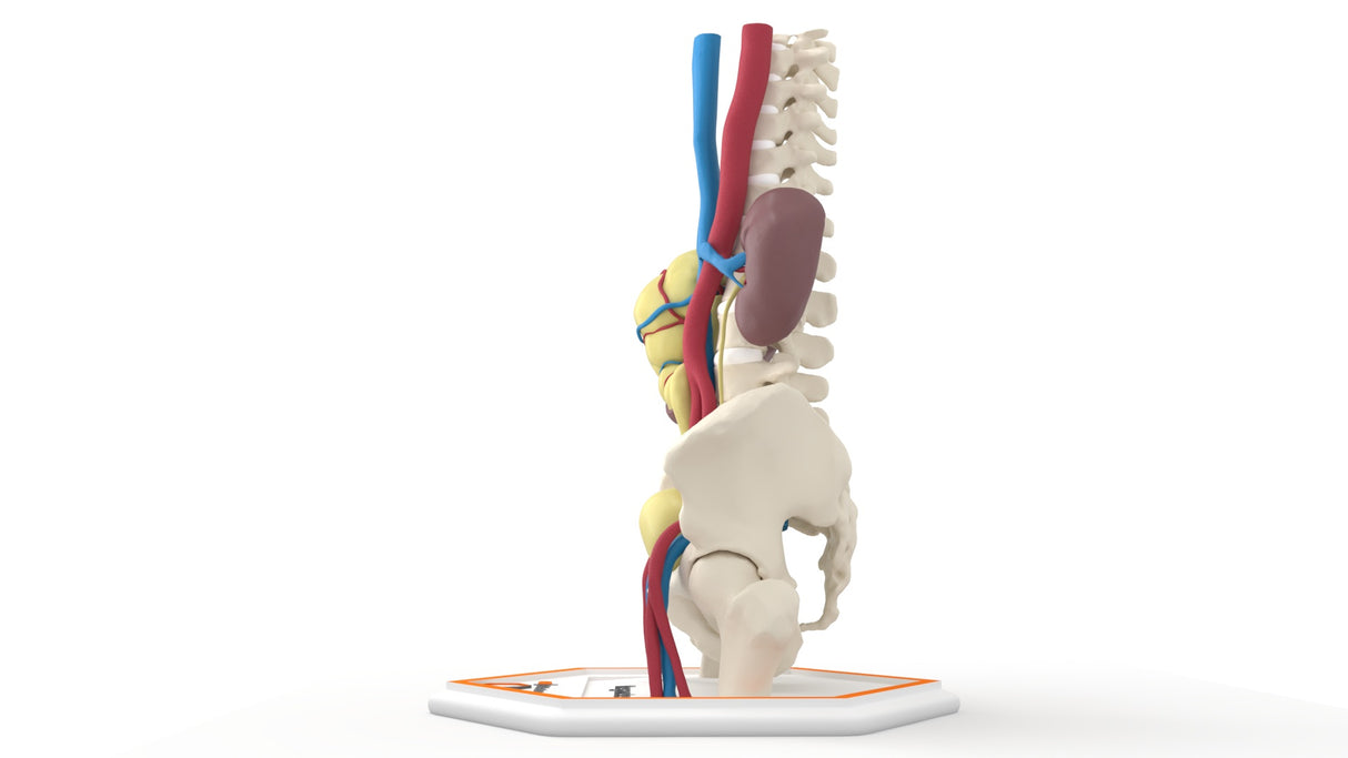 Mega Ureter – 48 M