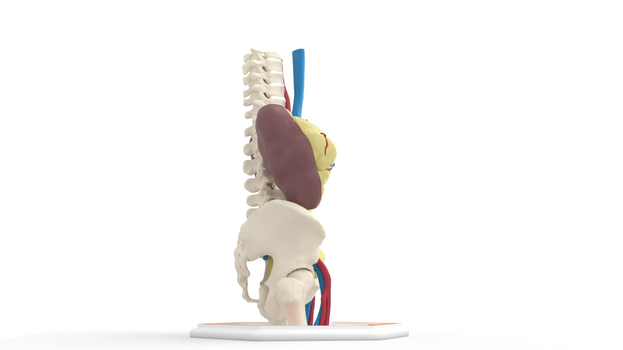 Mega Ureter – 48 M