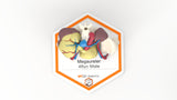 Mega Ureter – 48 M