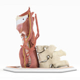 Zenker's Diverticulum (Pharyngoesophageal Diverticulum)