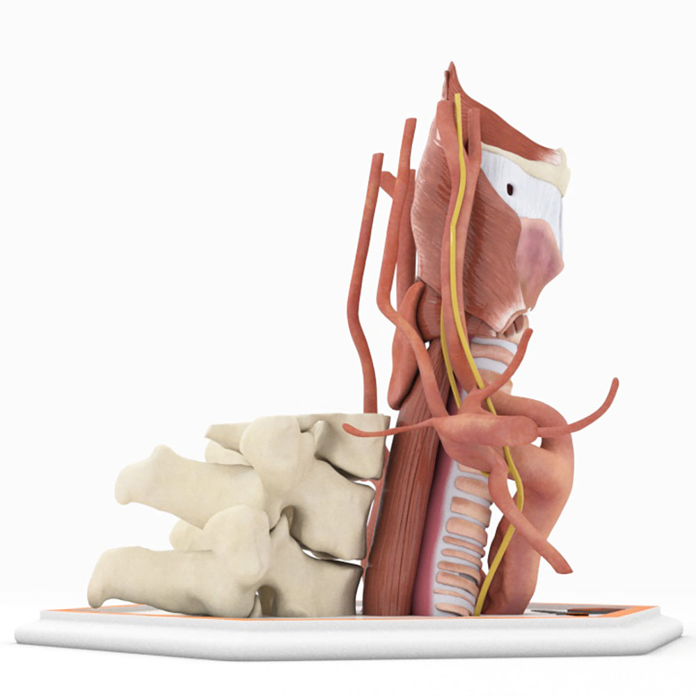Zenker's Diverticulum (Pharyngoesophageal Diverticulum)