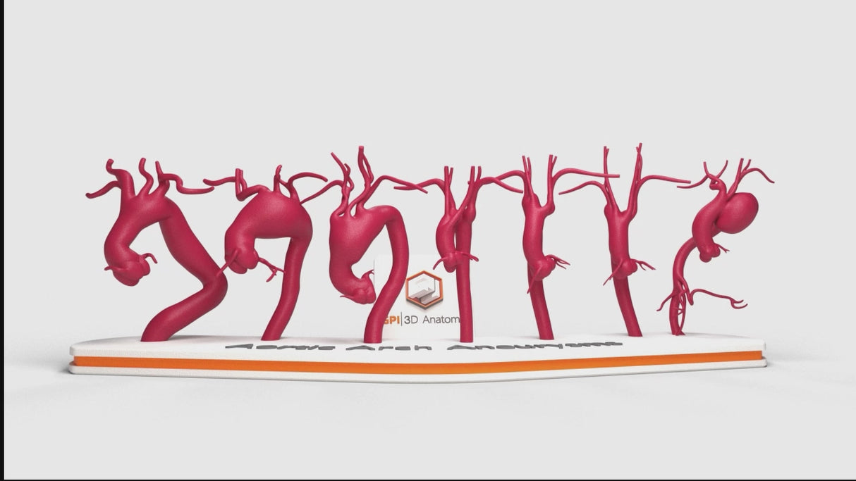 Aortic Arch Aneurysm Set